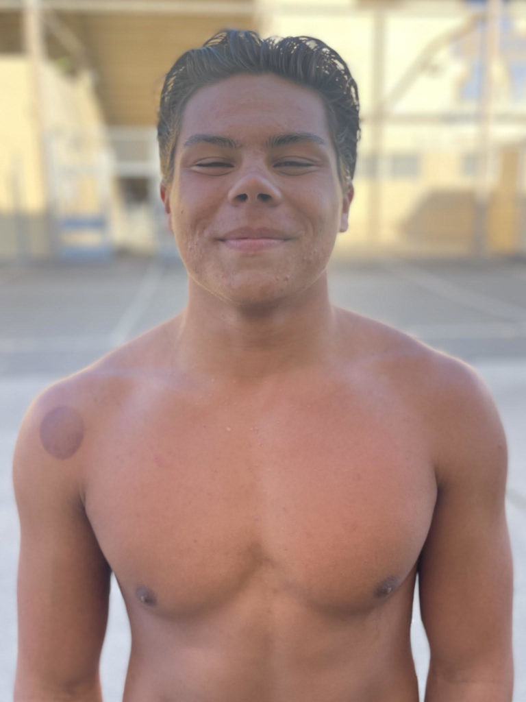 Samson Casem